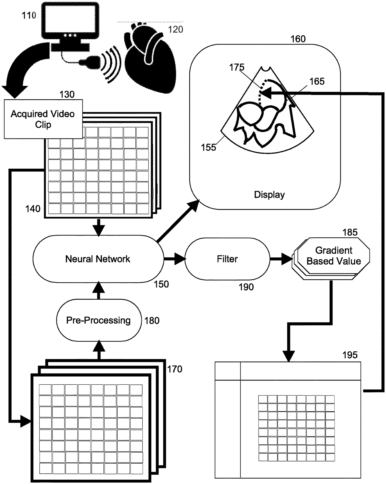 Patent drawing for a cardiac ultrasound AI system